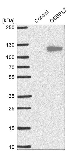 OSBPL7 Antibody Western Blot: OSBPL7 Antibody [OSBPL7 Antibody]