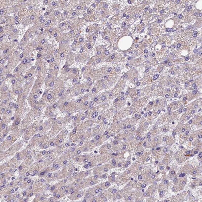 FUNDC1 Antibody - BSA Free Immunohistochemistry-Paraffin: FUNDC1 Antibody [NBP1-81063]