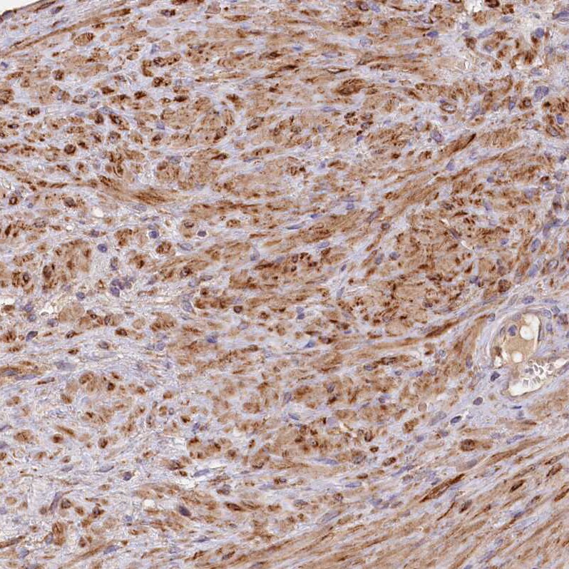 FUNDC1 Antibody - BSA Free Immunohistochemistry-Paraffin: FUNDC1 Antibody [NBP1-81063]