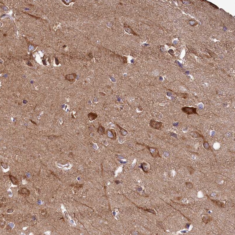 FUNDC1 Antibody - BSA Free Immunohistochemistry-Paraffin: FUNDC1 Antibody [NBP1-81063]