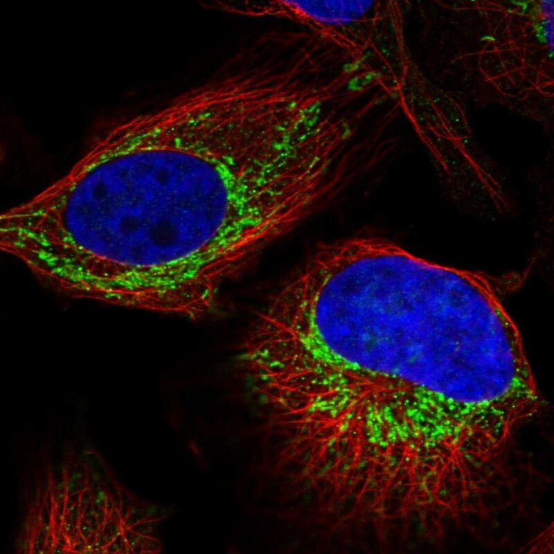 ZNF678 Antibody - BSA Free Immunocytochemistry/ Immunofluorescence: ZNF678 Antibody [NBP1-81079]