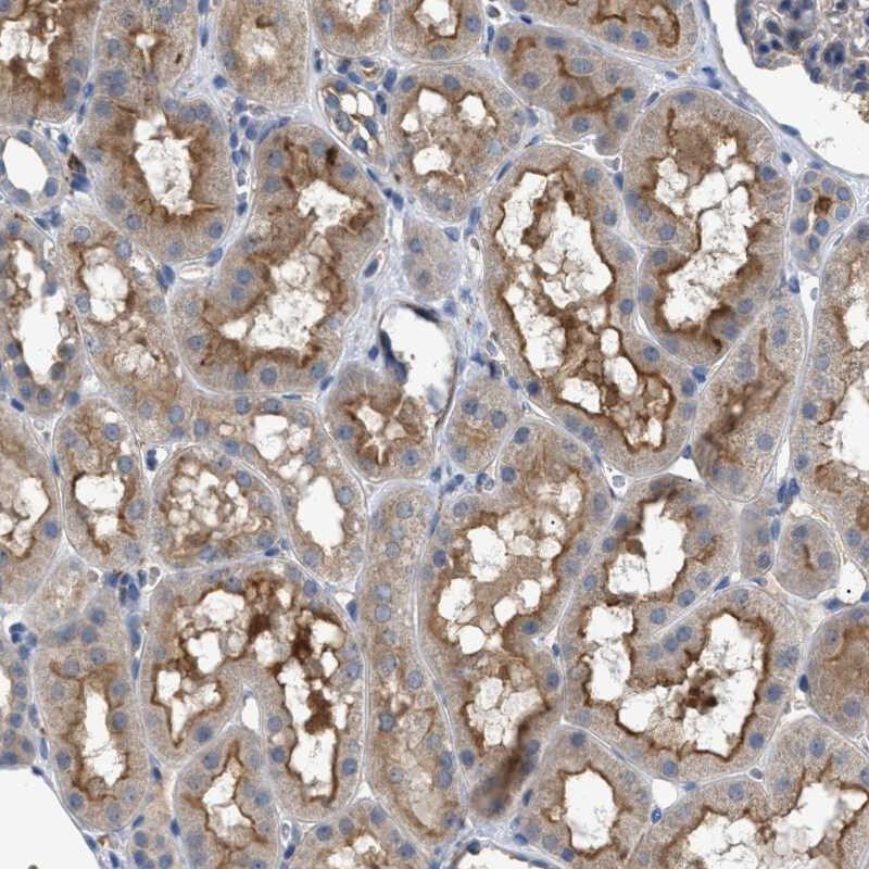 VSTM2A Antibody - BSA Free Immunohistochemistry-Paraffin: VSTM2A Antibody [NBP1-81114]