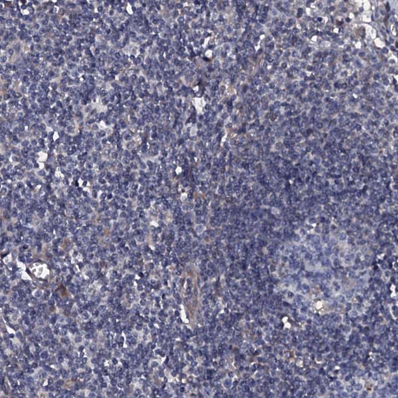 TMEM151A Antibody - BSA Free Immunohistochemistry-Paraffin: TMEM151A Antibody [NBP1-81115]