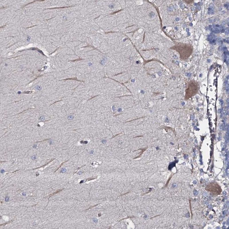 TMEM151A Antibody - BSA Free Immunohistochemistry-Paraffin: TMEM151A Antibody [NBP1-81115]