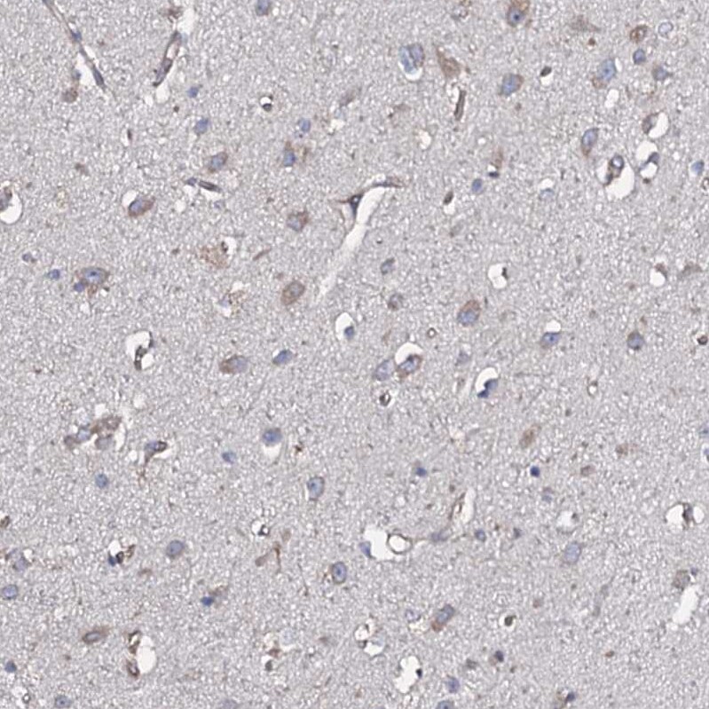 TMEM151A Antibody - BSA Free Immunohistochemistry-Paraffin: TMEM151A Antibody [NBP1-81115]