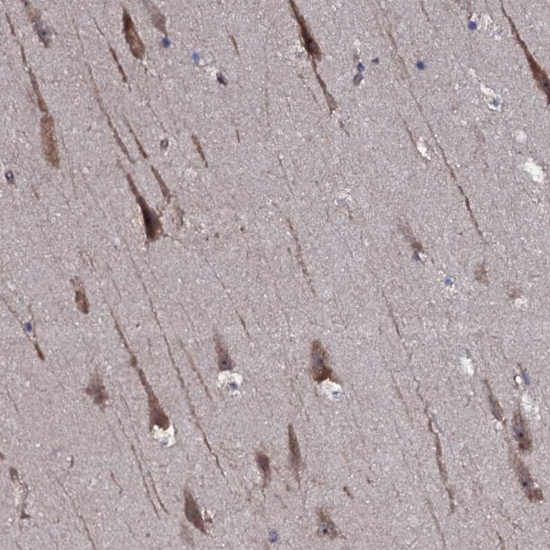 TMEM151A Antibody - BSA Free Immunohistochemistry-Paraffin: TMEM151A Antibody [NBP1-81115]