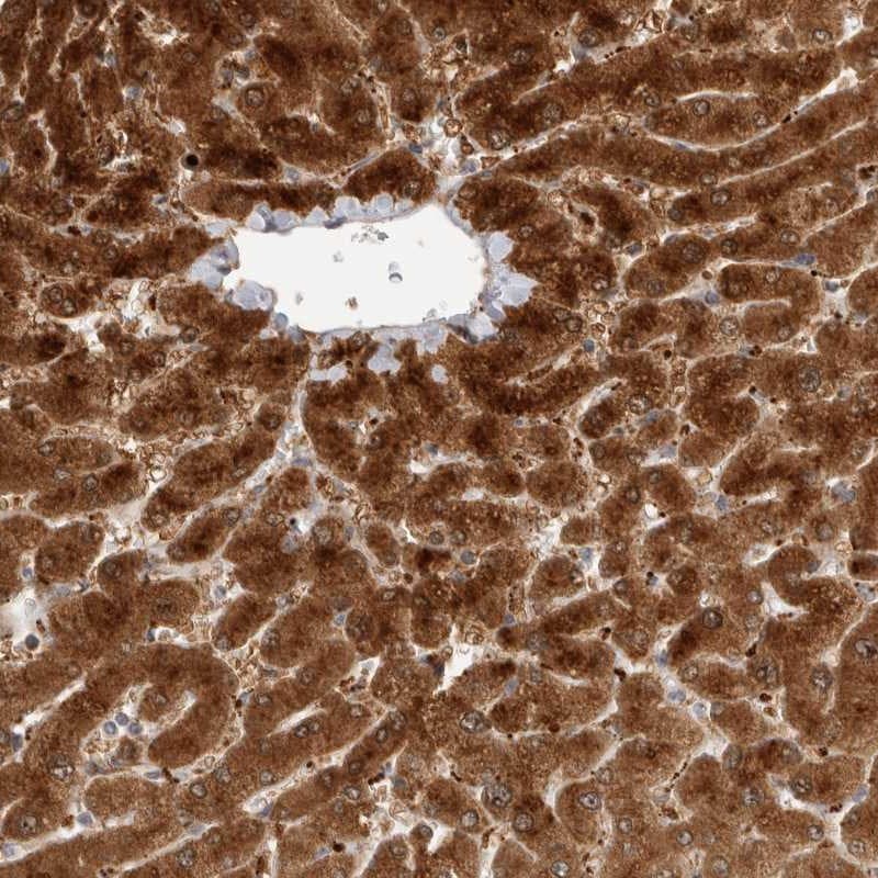 ACTL9 Antibody - BSA Free Immunohistochemistry: ACTL9 Antibody - BSA Free [NBP1-81116]
