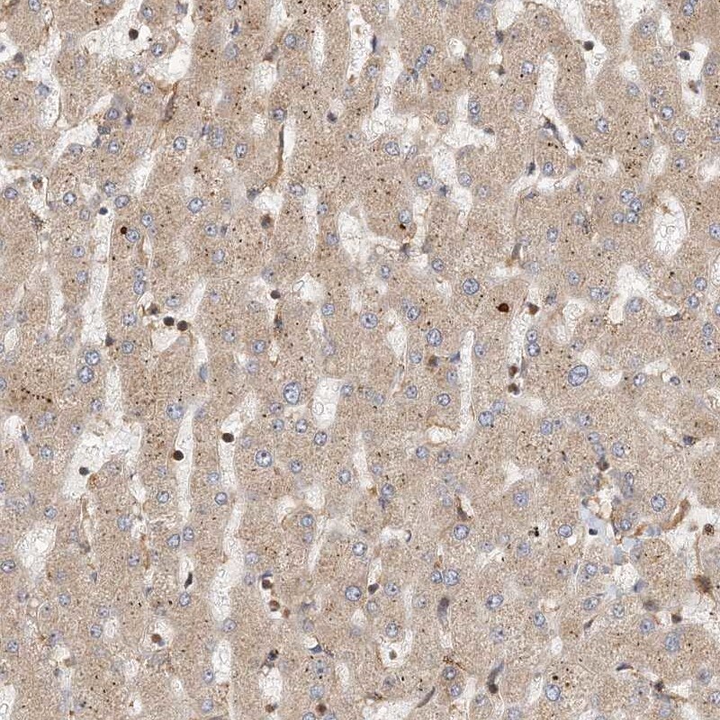 CL-K1/COLEC11 Antibody - BSA Free Immunohistochemistry: CL-K1/COLEC11 Antibody - BSA Free [NBP1-81120]