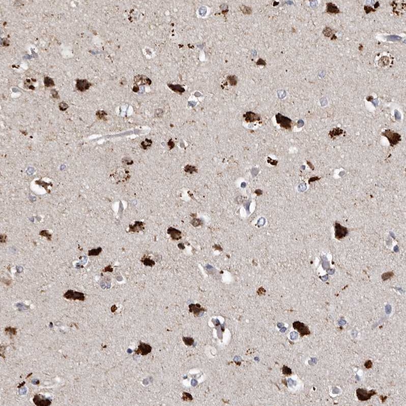 SLC10A4 Antibody - BSA Free Immunohistochemistry: SLC10A4 Antibody - BSA Free [NBP1-81134]