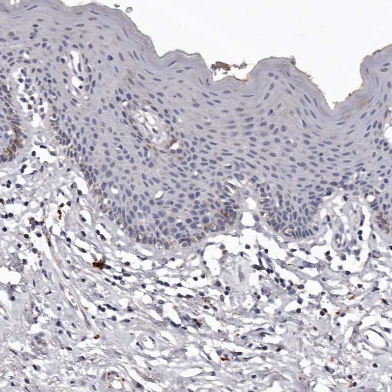 SLC10A4 Antibody - BSA Free Immunohistochemistry: SLC10A4 Antibody - BSA Free [NBP1-81134]