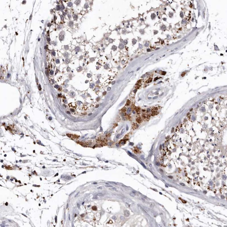 SLC10A4 Antibody - BSA Free Immunohistochemistry: SLC10A4 Antibody - BSA Free [NBP1-81134]