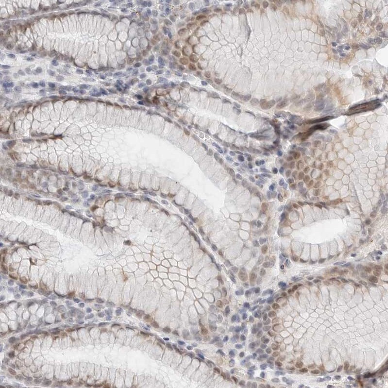 TSEN2 Antibody - BSA Free Immunohistochemistry-Paraffin: TSEN2 Antibody [NBP1-81140]