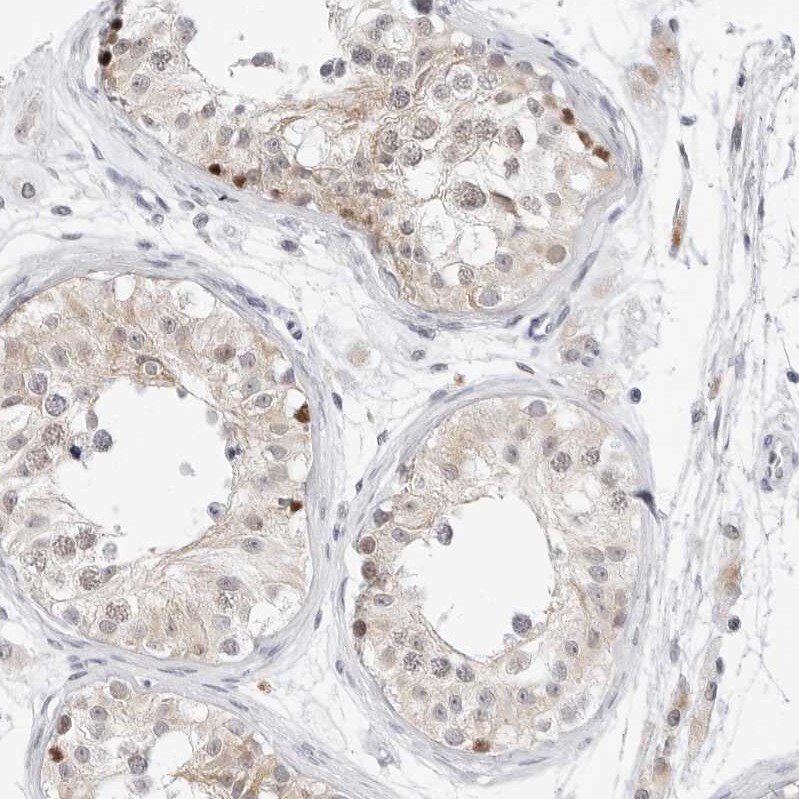 TSEN2 Antibody - BSA Free Immunohistochemistry-Paraffin: TSEN2 Antibody [NBP1-81140]