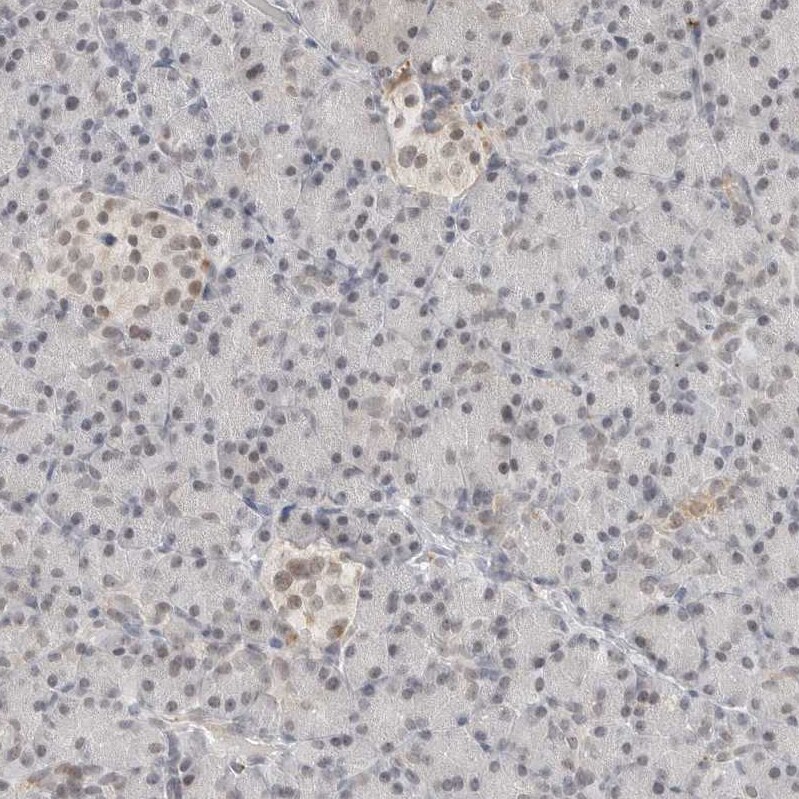 TSEN2 Antibody - BSA Free Immunohistochemistry-Paraffin: TSEN2 Antibody [NBP1-81140]