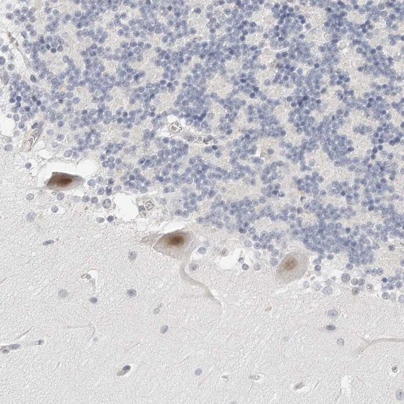 TSEN2 Antibody - BSA Free Immunohistochemistry-Paraffin: TSEN2 Antibody [NBP1-81140]