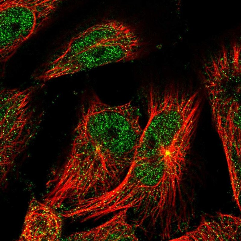 TSEN2 Antibody - BSA Free Immunocytochemistry/ Immunofluorescence: TSEN2 Antibody [NBP1-81141]
