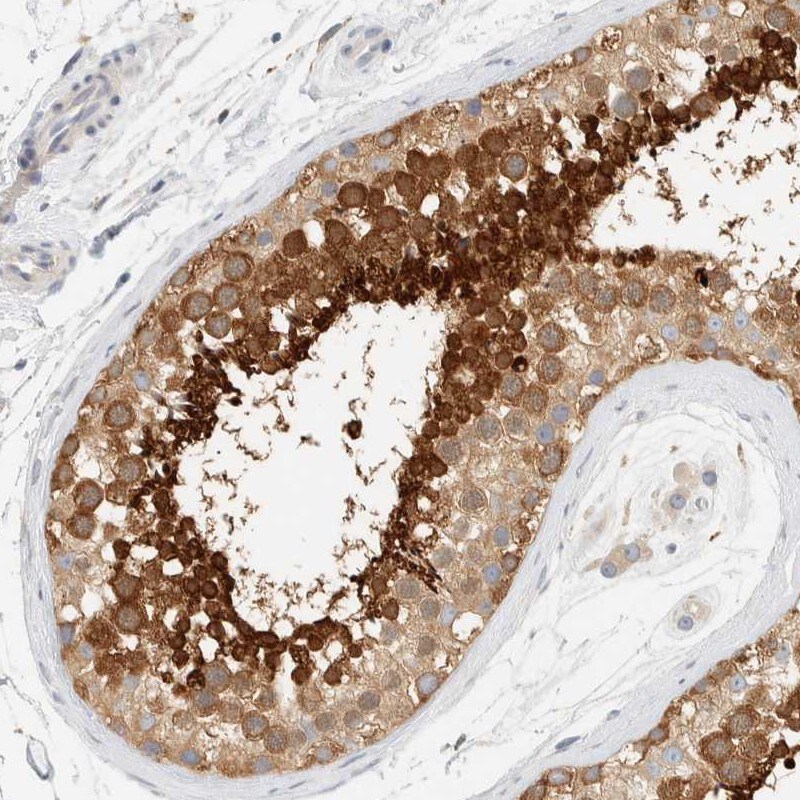 AARSD1 Antibody - BSA Free Immunohistochemistry-Paraffin: AARSD1 Antibody [NBP1-81143]