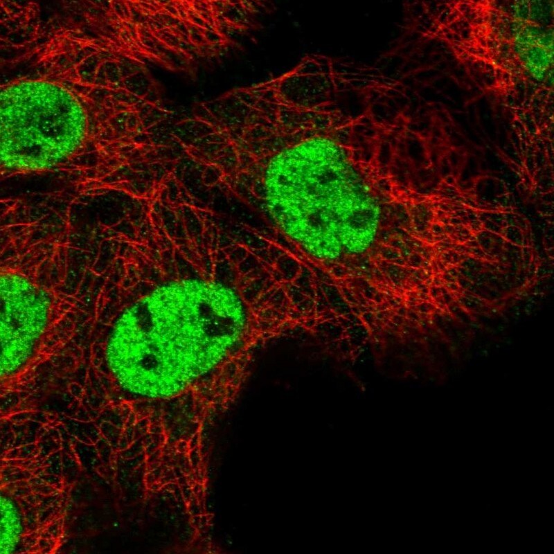 RNF26 Antibody - BSA Free Immunocytochemistry/ Immunofluorescence: RNF26 Antibody [NBP1-81150]