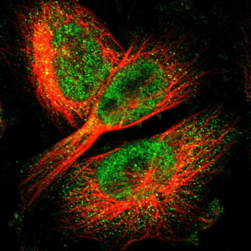 LBHD1 Antibody - BSA Free Immunocytochemistry/ Immunofluorescence: LBHD1 Antibody [NBP1-81156]
