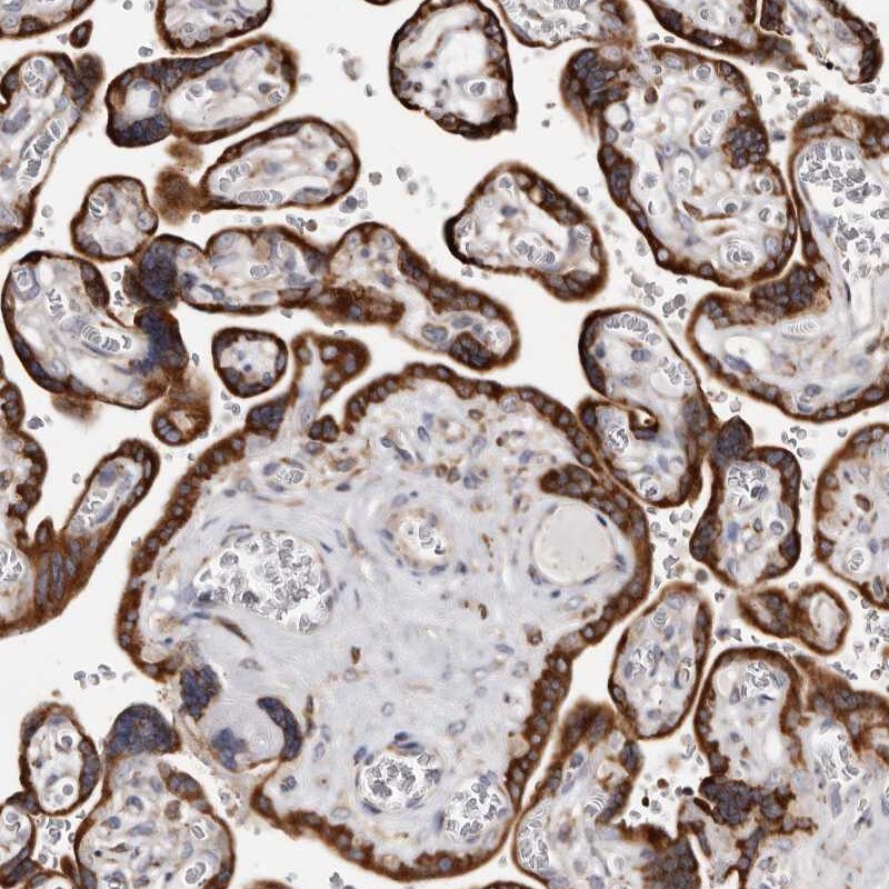 ACBD6 Antibody - BSA Free Immunohistochemistry: ACBD6 Antibody - BSA Free [NBP1-81158]