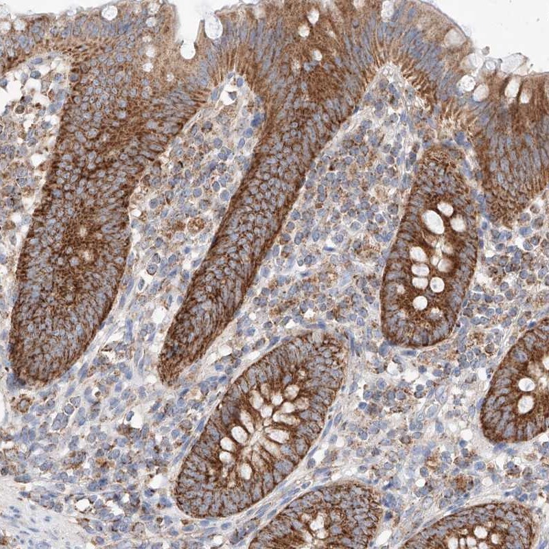 KTI12 Antibody - BSA Free Immunohistochemistry-Paraffin: KTI12 Antibody [NBP1-81177]