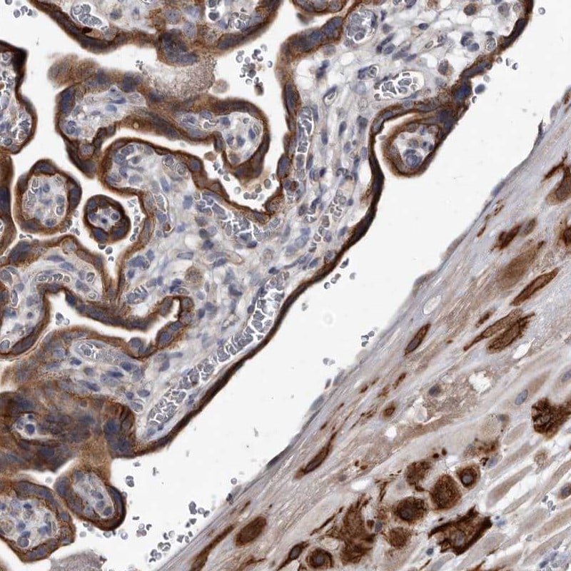 YPEL3 Antibody - BSA Free Immunohistochemistry: YPEL3 Antibody - BSA Free [NBP1-81237]