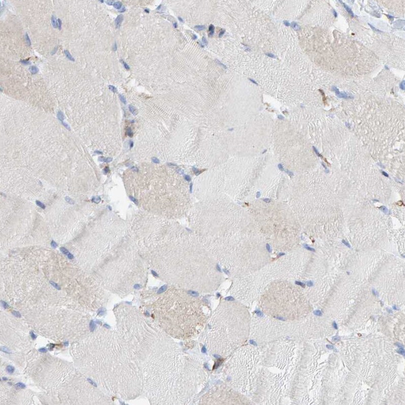 MAP1B Antibody - BSA Free Immunohistochemistry-Paraffin: MAP1B Antibody [NBP1-81261]