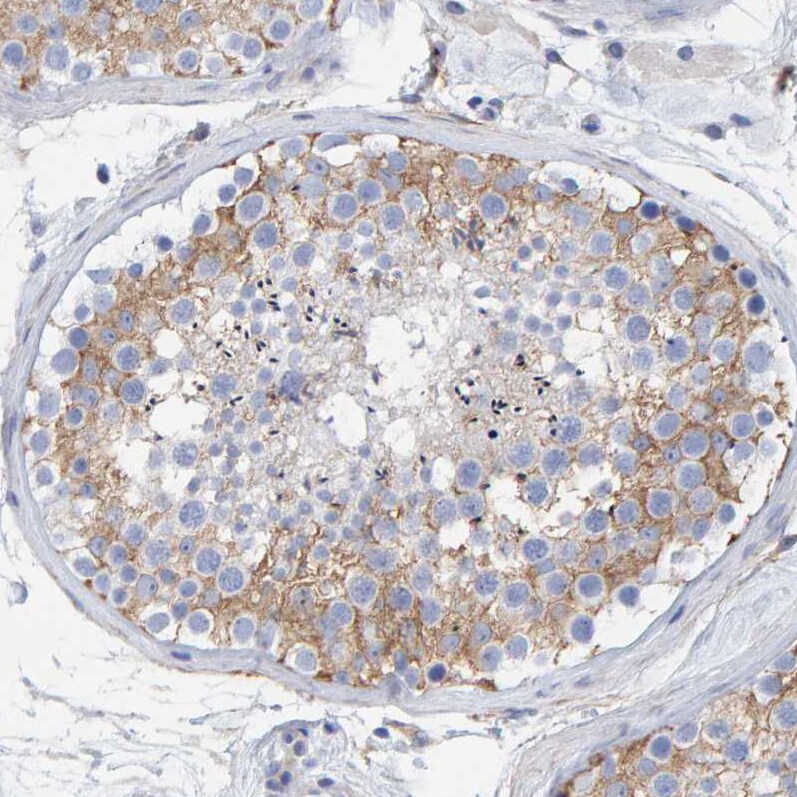 MAP1B Antibody - BSA Free Immunohistochemistry-Paraffin: MAP1B Antibody [NBP1-81261]