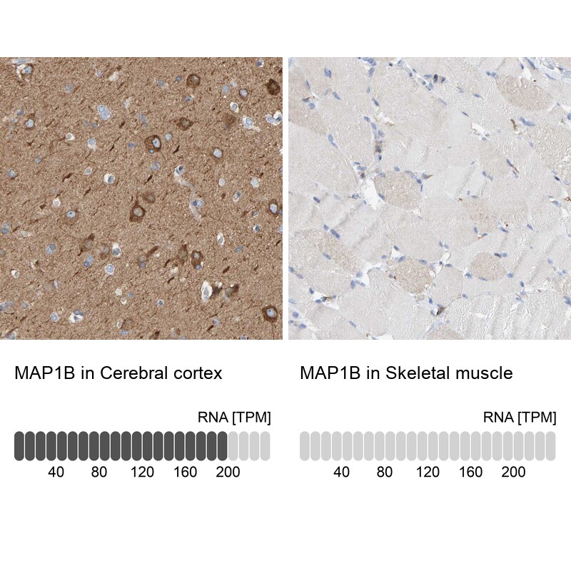 MAP1B Antibody - BSA Free Immunohistochemistry-Paraffin: MAP1B Antibody [NBP1-81261]
