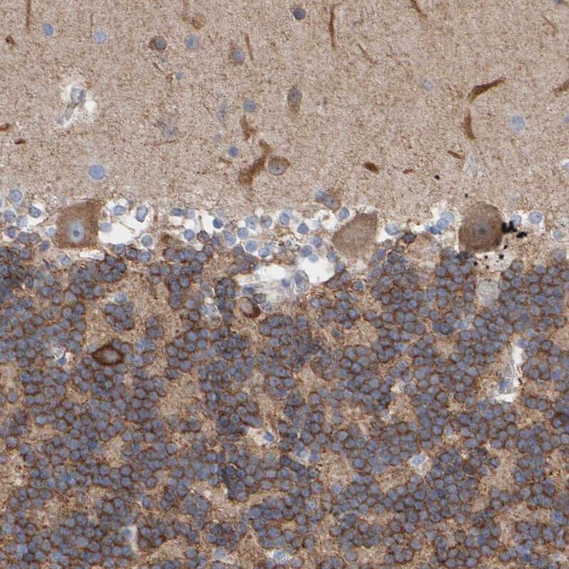 MAP1B Antibody - BSA Free Immunohistochemistry-Paraffin: MAP1B Antibody [NBP1-81261]