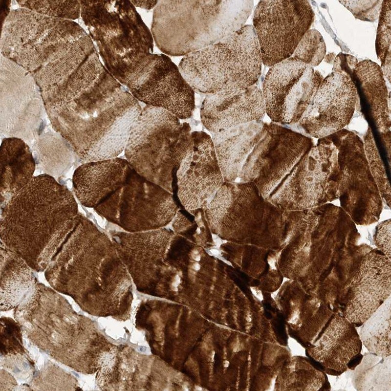 NAP1 Antibody - BSA Free Immunohistochemistry: NAP1 Antibody - BSA Free [NBP1-81262]