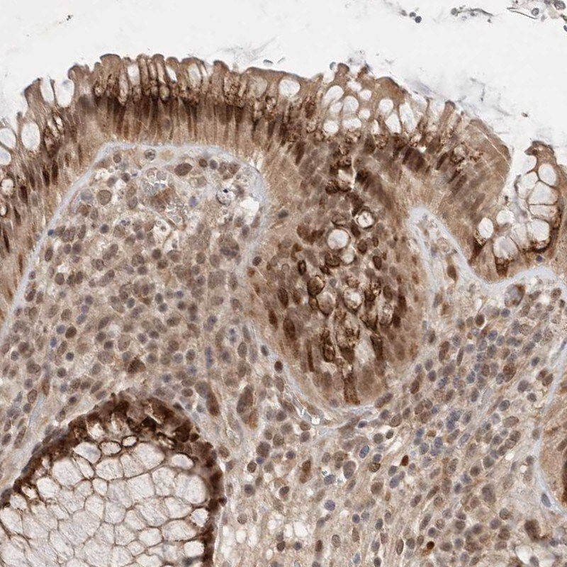 LEMD3 Antibody - BSA Free Immunohistochemistry-Paraffin: LEMD3 Antibody [NBP1-81265]