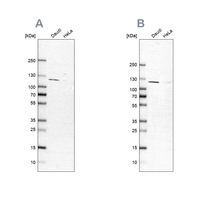 LEMD3 Antibody Western Blot: LEMD3 Antibody Antibody [NBP1-81265]