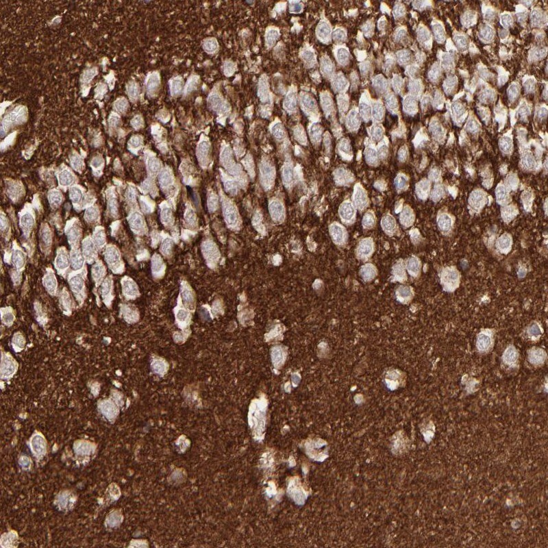 GPM6B Antibody - BSA Free Immunohistochemistry-Paraffin: GPM6B Antibody [NBP1-81271]
