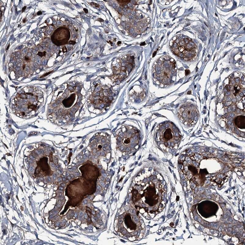 LYG2 Antibody - BSA Free Immunohistochemistry-Paraffin: LYG2 Antibody [NBP1-81278]