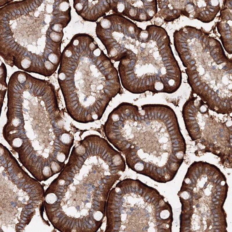 SLC36A1 Antibody - BSA Free Immunohistochemistry: SLC36A1 Antibody - BSA Free [NBP1-81280]
