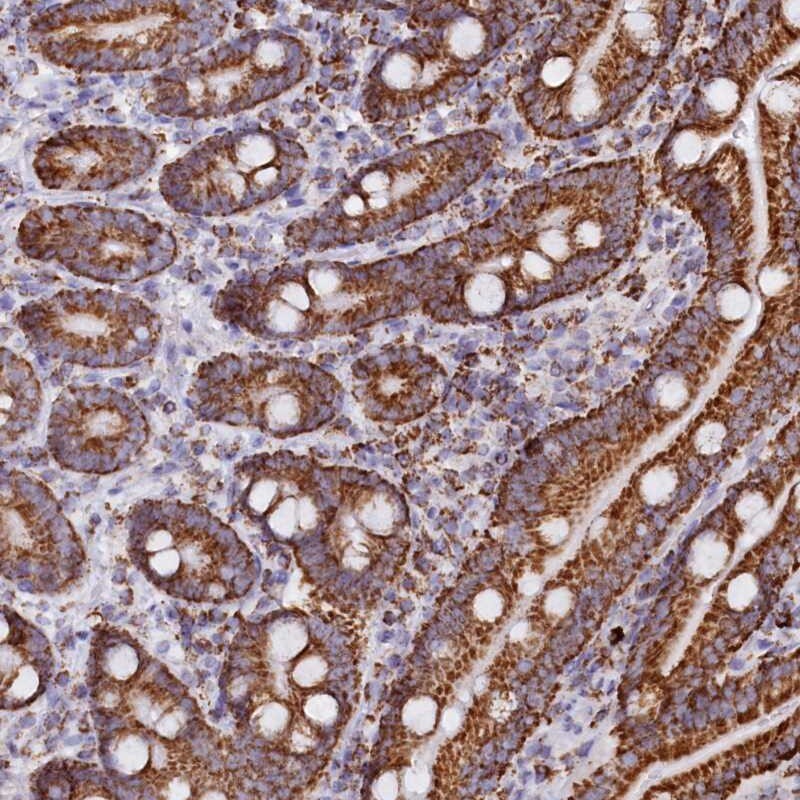 C1D Antibody - BSA Free Immunohistochemistry-Paraffin: C1D Antibody [NBP1-81287]