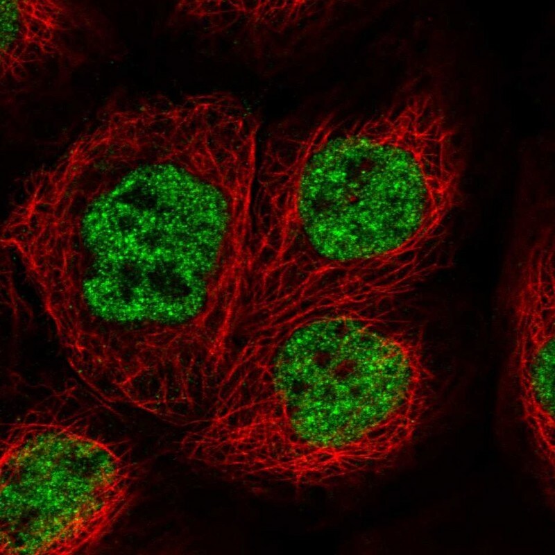 THRSP Antibody - BSA Free Immunocytochemistry/ Immunofluorescence: THRSP Antibody [NBP1-81290]