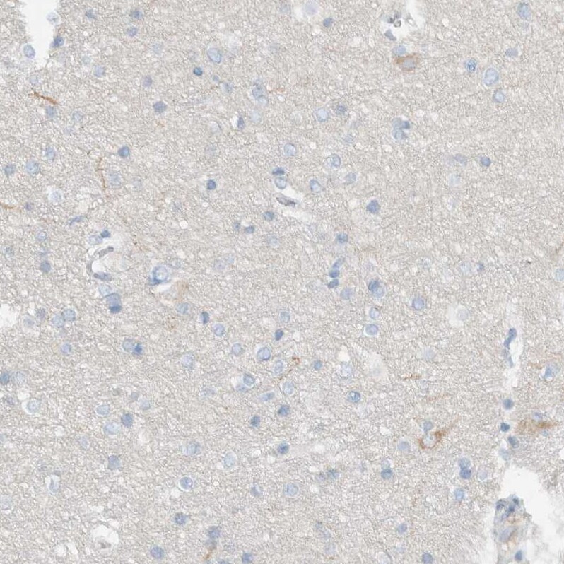 DUOX1 Antibody - BSA Free Immunohistochemistry: DUOX1 Antibody - BSA Free [NBP1-81301]