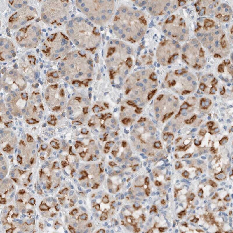 DUOX1 Antibody - BSA Free Immunohistochemistry: DUOX1 Antibody - BSA Free [NBP1-81301]