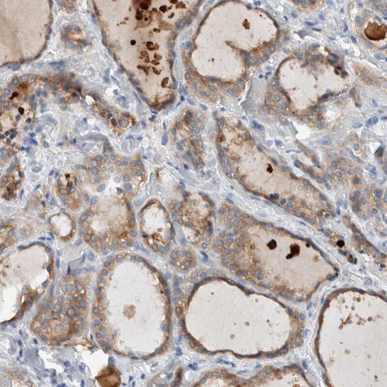 DUOX1 Antibody - BSA Free Immunohistochemistry: DUOX1 Antibody - BSA Free [NBP1-81301]