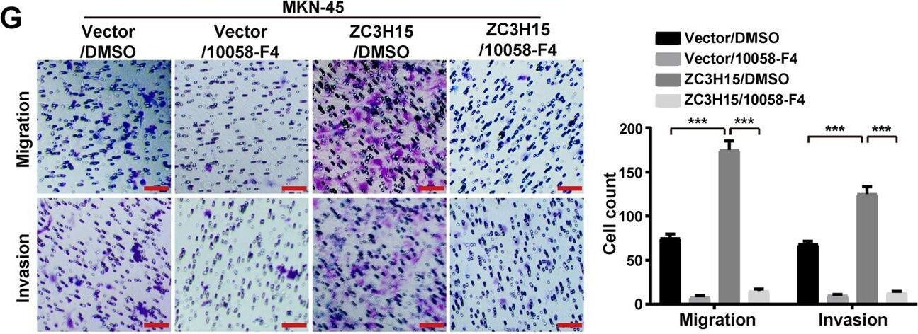 ZC3H15 Antibody - BSA Free
