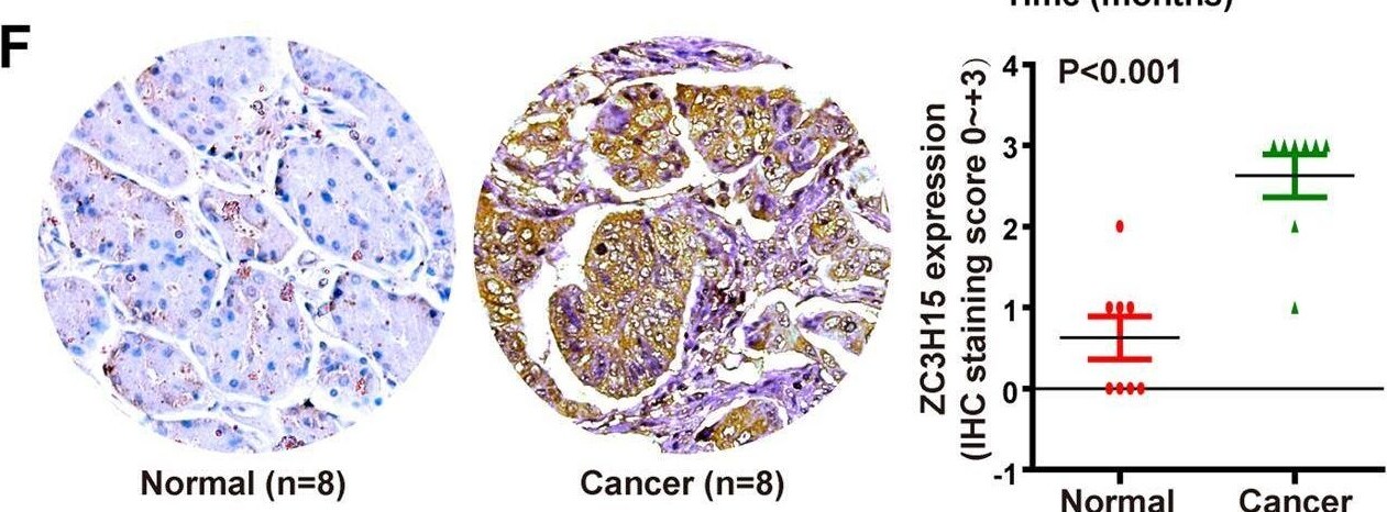 ZC3H15 Antibody - BSA Free