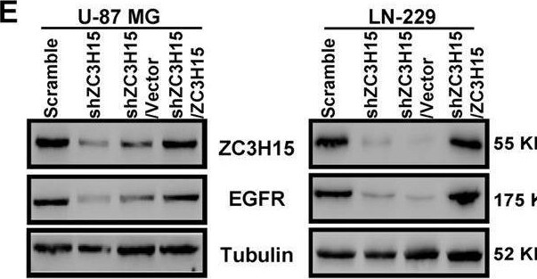ZC3H15 Antibody - BSA Free