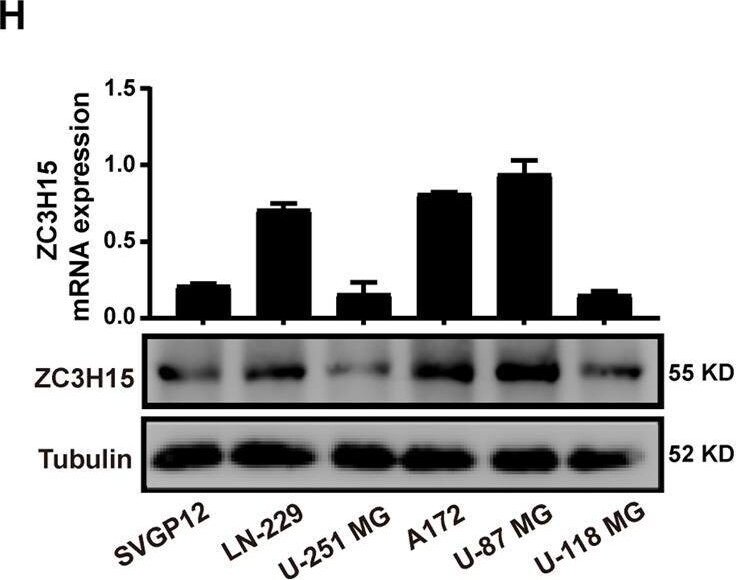 ZC3H15 Antibody - BSA Free