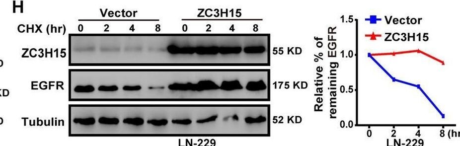 ZC3H15 Antibody - BSA Free