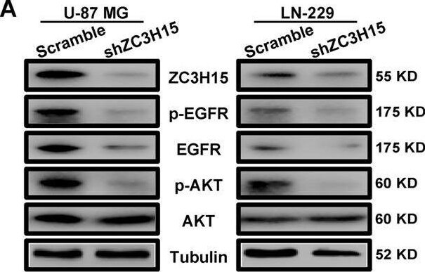ZC3H15 Antibody - BSA Free