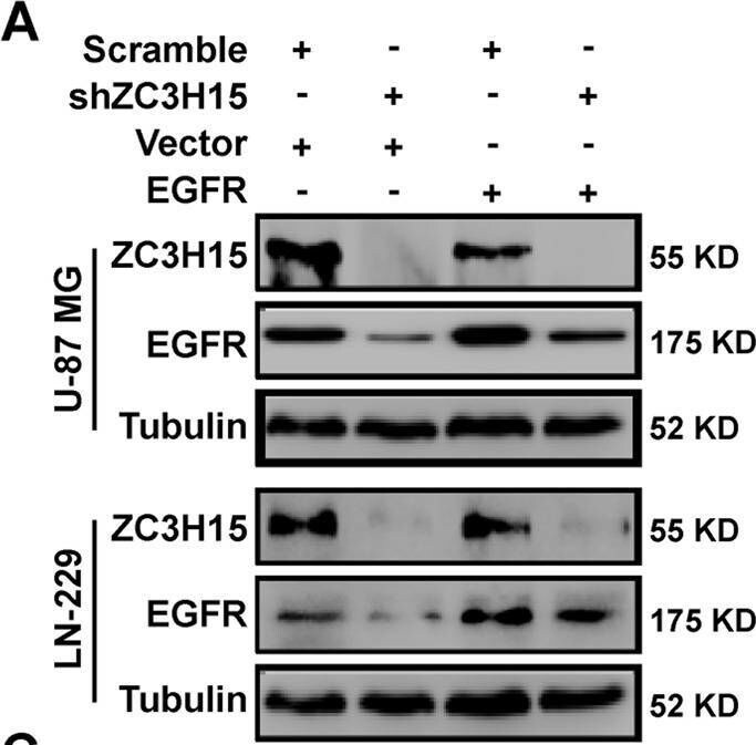 ZC3H15 Antibody - BSA Free
