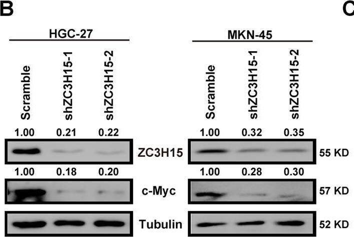 ZC3H15 Antibody - BSA Free