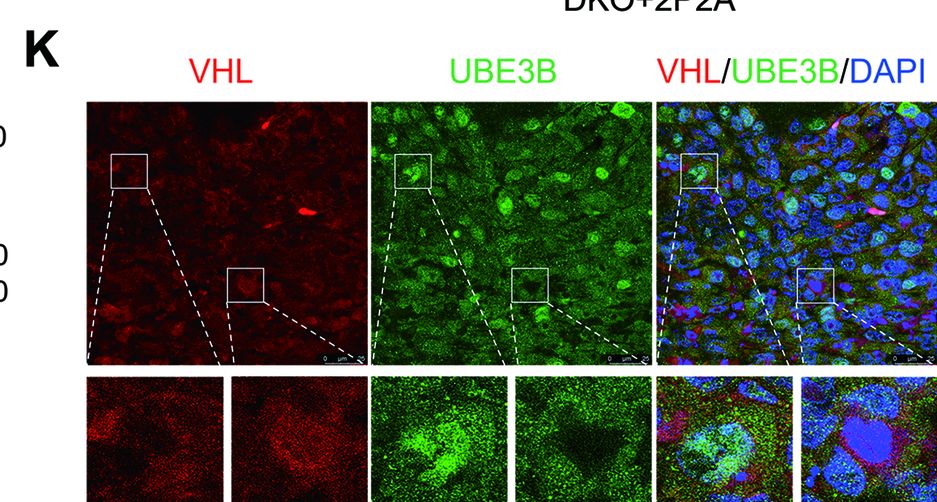 UBE3B Antibody - BSA Free